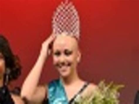 brave bald and beautiful girl ditches wig and wins pageant