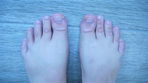 How To Get Rid Of Dead Skin On Feet Step By Step Guide Cushy Spa