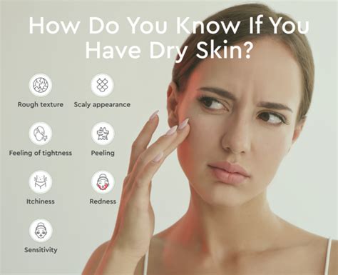 Can You Get Acne From Dry Skin