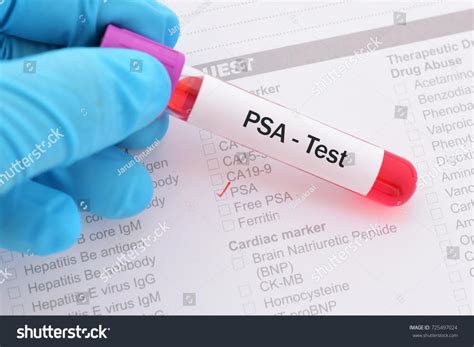 Testing PSA Levels Midtown Urology Associates Urologists