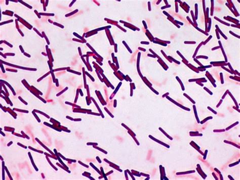 Bacillus Subtilis Gram Stain Positive Or Negative