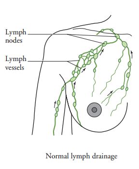Hand And Arm Guidelines After Your Axillary Lymph Node Dissection