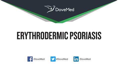 Erythrodermic Psoriasis