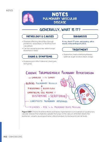 Pulmonary Vascular Disease Notes Diagrams Illustrations Osmosis