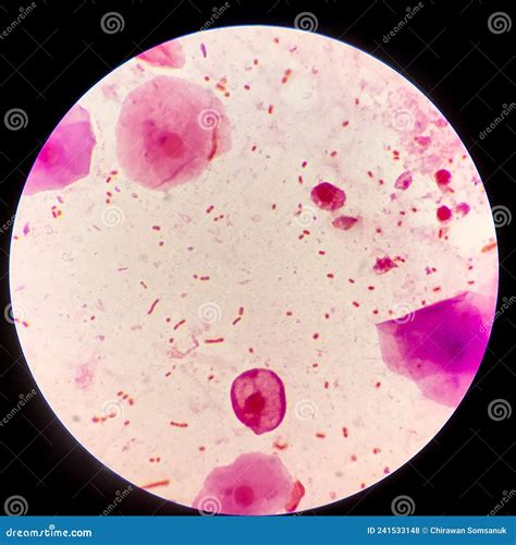 Bacillus Gram Positive Stain Under Microscope View Bacillus Is Rod