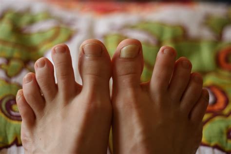 Poor nutrition has been shown to slow nail growth, says dr. Yo Momma Runs: Help, my toenail is coming off!