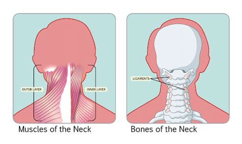 Stiff Neck Causes Related Conditions And Treatment