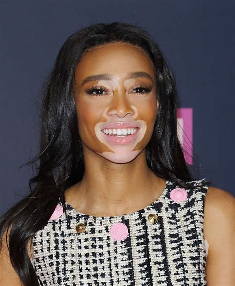 Winnie Harlow Is A High Fashion Storm With Her New Hairstyle
