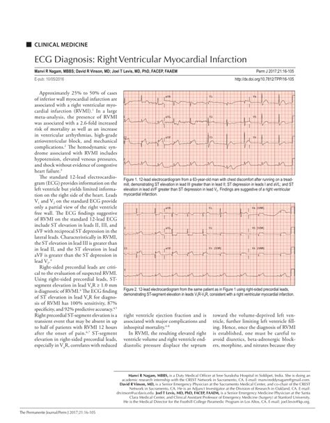 Pdf Ecg Diagnosis Right Ventricular Myocardial Infarction