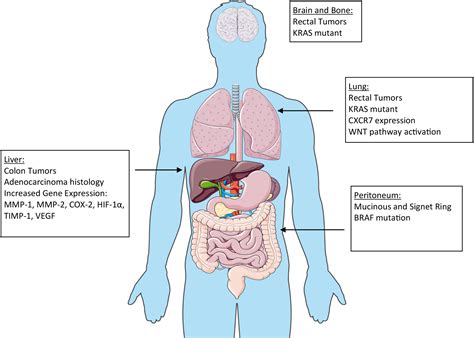 Surgical Treatment Of Metastatic Colorectal Cancer Surgical Oncology