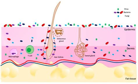 Acne Vulgaris Diagram