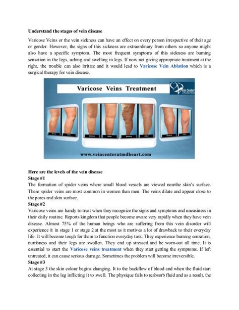 Understand The Stages Of Vein Disease