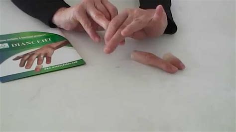 Index Middle And Ring Prosthetic Fingers No Youtube