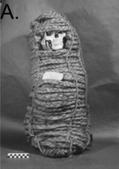 Antibiotic Resistance Genes Discovered In 900 Year Old Incan Mummy