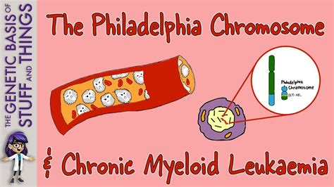 Chronic Myeloid Leukaemia Discovery Of The Philadelphia Chromosome Youtube