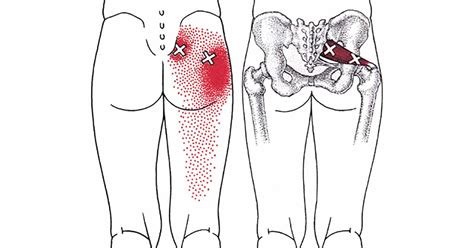 Muscles and tendons in the hip. Piriformis Stretch For Sciatica - How To Videos & Pictures