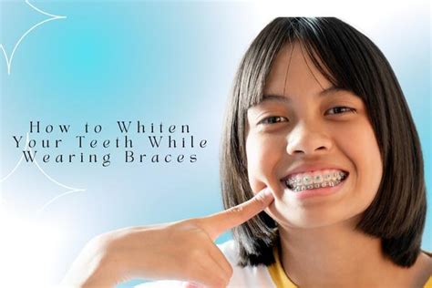 how to whiten your teeth while wearing braces my smiles