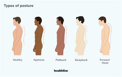 Types Of Posture How To Correct Bad Posture Posture Brace Proper