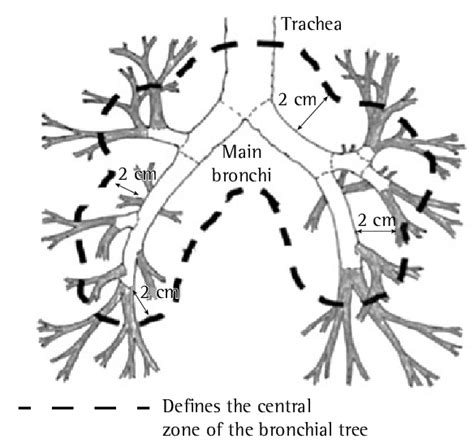 Definition Of Central Zone Region Within A Radius Of 2 Cm Around The