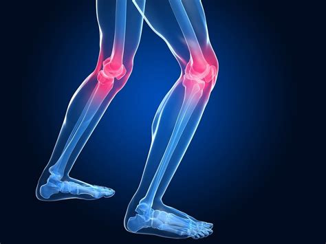Knee Pain Treatment In Calgary