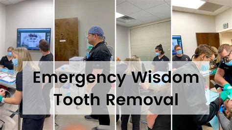 Wisdom Teeth Emergency Removal All Out Wisdom Teeth