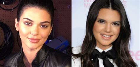 “it Doesnt Make Sense” Kendall Jenner Denies Having Lip Fillers