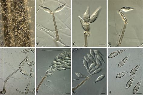 https://www.researchgate.net/figure/267761096_fig18_Pyricularia-pennisetigena-ML0036-A-Sporulation-on-sterile-barley-leaf-on-SNA-B-G