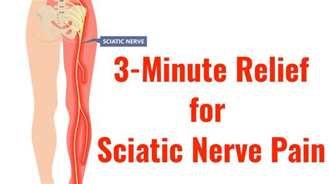 How To Heal Sciatic Nerve Pain Desksandwich