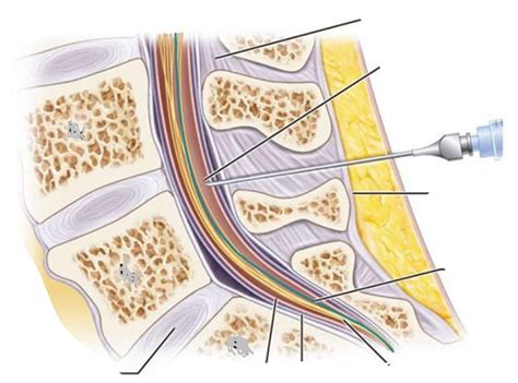 Lumbar Puncture Anatomy Diagram Quizlet
