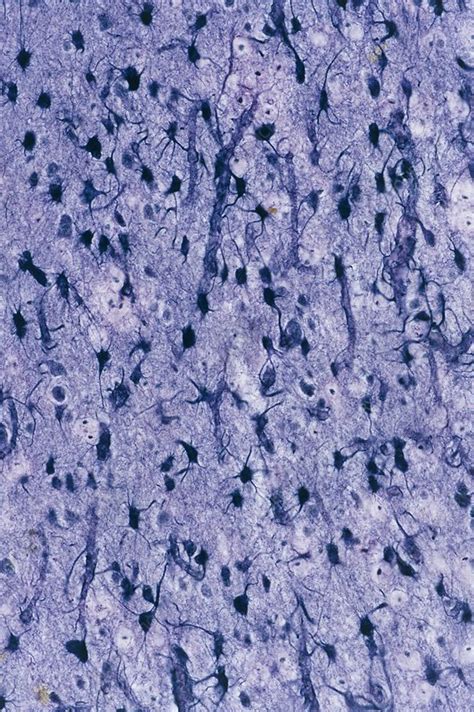 Brain Glial Cells Light Micrograph Stock Image C0160523 Science