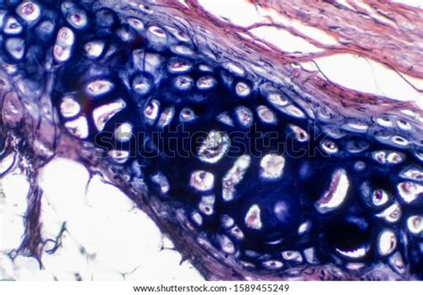 Human Hyaline Cartilage Bone Under Microscope Stock Photo
