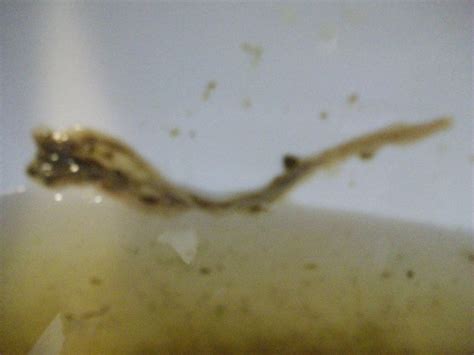 Check spelling or type a new query. this is not a "roundworm"!!!!!!! at Parasites Support ...