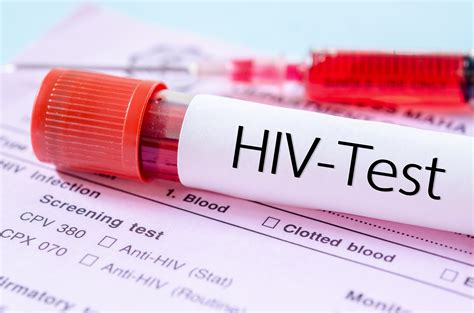 hiv aids disease