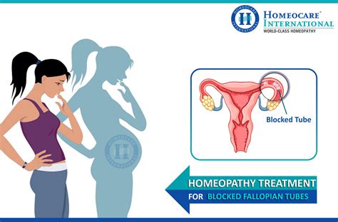 Worried About Your Blocked Fallopian Tubes Treat Them With Homeopathy