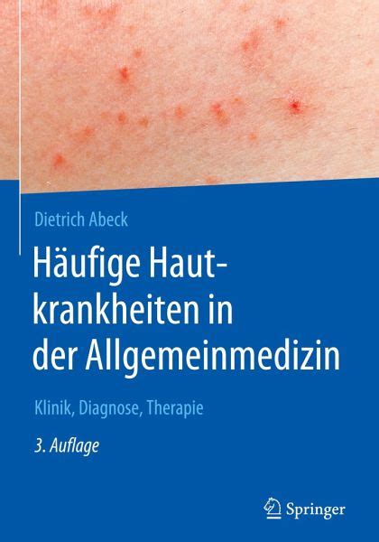 Häufige Hautkrankheiten in der Allgemeinmedizin von Dietrich Abeck Fachbuch bücher de