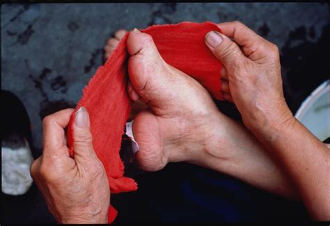 foot binding traditions of altering feet in china