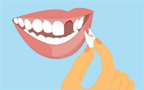 By using their tongue or their fingers, it usually only takes a few days to get the tooth to a point where it pops out completely on its own volition. Pull out a Loose Tooth | Funny and Loose tooth