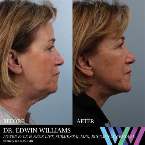 Williams Center Plastic Surgery Specialists Home