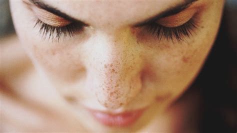 13 Home Remedies To Get Rid Of Dark Spots On Skin