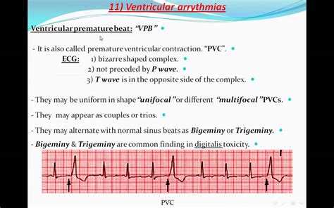 Principles Of Ecg Electrocardiography Part 10 Youtube