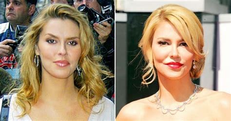 Brandi Glanville Plastic Surgery Before And After Pictures