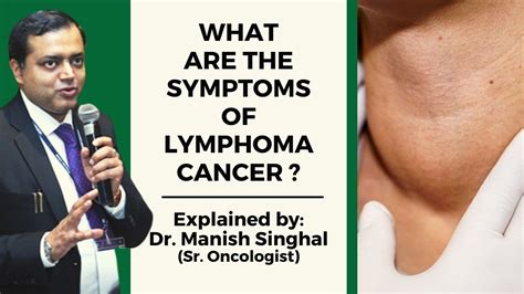 What Are Lymphoma Cancer Symptoms Explained By Dr Manish Singhal