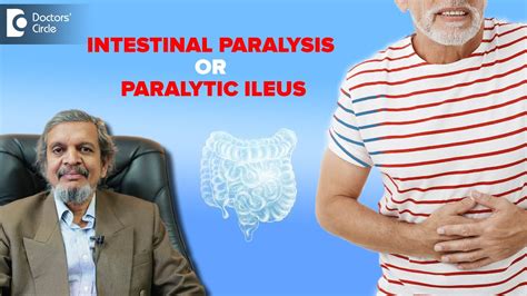 Intestinal Paralysis Paralytic Ileus Symptoms Treatments Dr