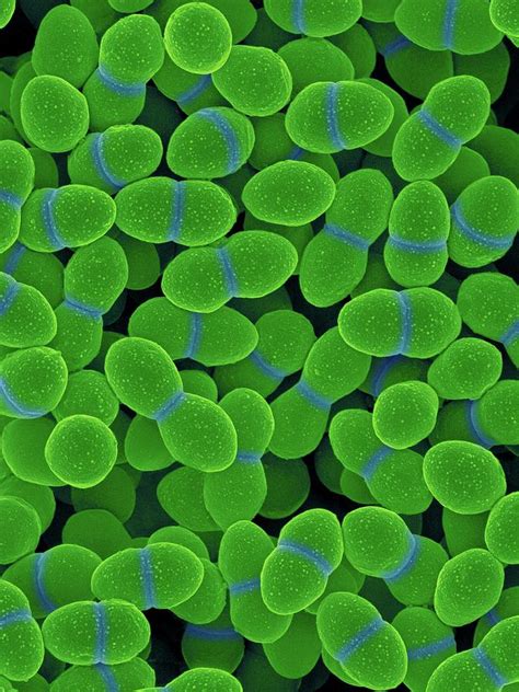 Enterococcus Faecalis Photograph By Dennis Kunkel Microscopyscience