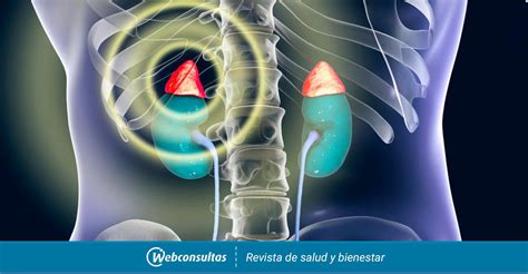 Enfermedad de Addison Causas síntomas y tratamiento