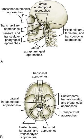 Tumors Of The Craniovertebral Junction Clinical Gate