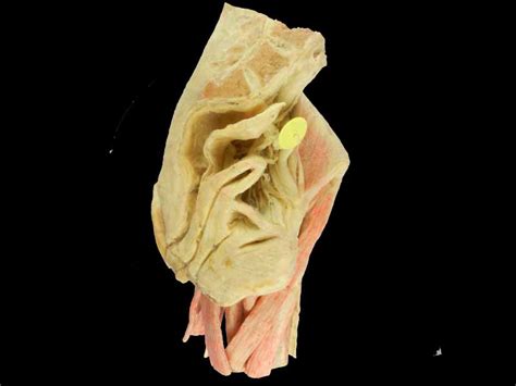 Skull, temple, ear, forehead, face, adam's apple , shoulder, nipple, breast, armpit, thorax, navel, abdomen, pubis, groin, knee, foot, toe, ankle, instep. Female internal genital organs plastinated specimens,human body anatomy model, anatomical specimens