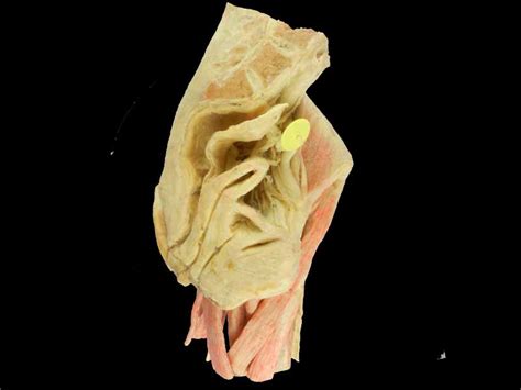 As many pictures and media files as possible should be. Female internal genital organs plastinated specimens,human body anatomy model, anatomical specimens