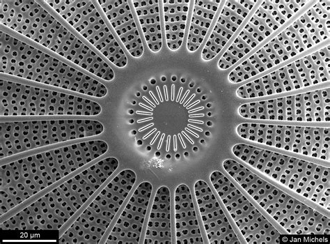 Electron Microscope Diatoms Micropedia
