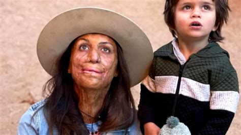 Turia Pitt Opens Up About Remarkable Recovery